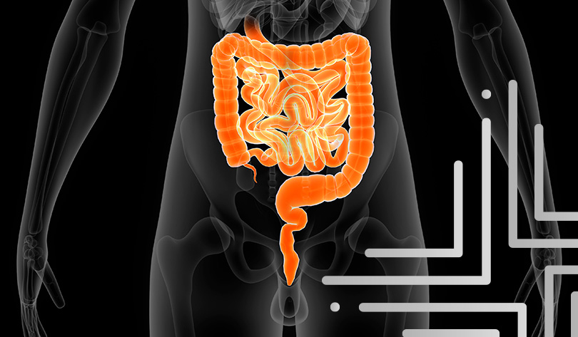 Paulo Chaib img-interna-Intestino-e-doenças-orificiais